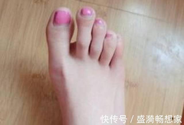 脚型|宝宝出生脚趾比手指还长,妈妈高兴不起来,网友基因突变