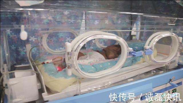 孕妇|高龄孕妇生二胎,仅仅七月剖腹产,打开肚子一片金黄