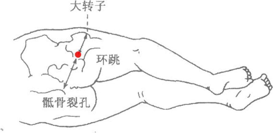 要穴|环跳穴,髋部及下肢疼痛的要穴;医生说:有三个功效,一个待验证