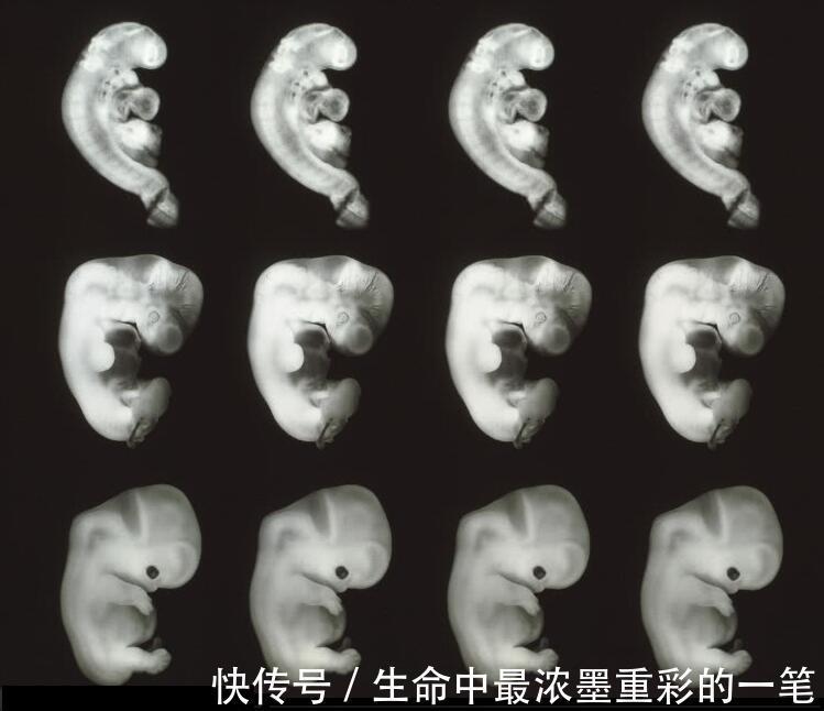 畸形|怀孕就像升级打怪,只要孕妇闯过3关,就可以安心等胎儿出生了