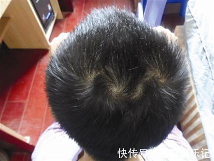 毛发|为什么有的孩子头上有“2个旋”？代表什么意思，父母要知道