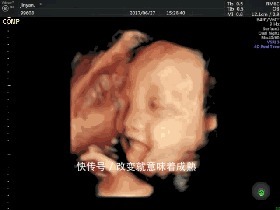 宝宝|宝宝聪不聪明,“娘胎”就能看出来,孕妈快来对照3个高智商反应