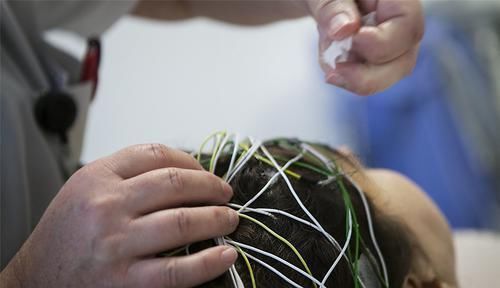 癫痫病|“裂脑人”拥有过人智慧,被认为拥有超能力,其实他们极为痛苦!