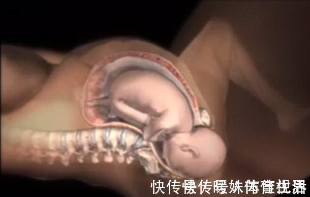 产妇|分娩最痛苦的不是产妇,而是产道里的宝宝?一般人都难以忍受