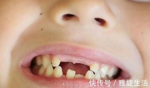 孩子|孩子“乳牙”脱落别着急扔,关键时刻能救命不懂为啥尽快了解下