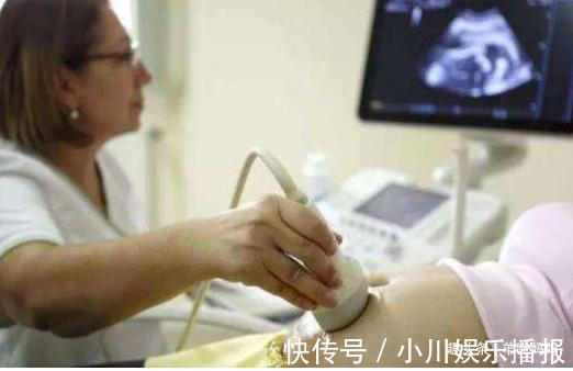 代表色|孕检做B超时,医生的这些“小暗号”要了解,是在暗示你胎儿性别