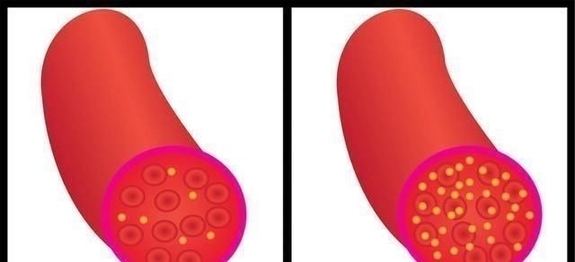 并发症|内科医生热水里撒一把，连喝1月，血糖降了，跟糖尿病“再见”