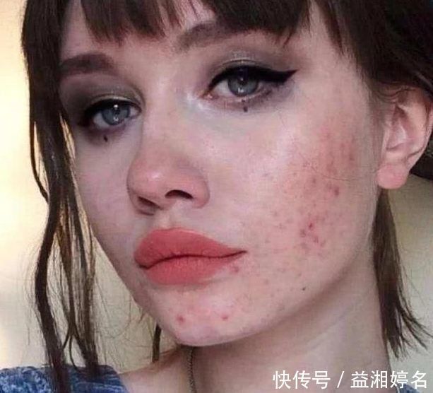 痘痘克星|这3水果被称“痘痘克星”,女生多吃能“战痘成功”,牛奶肌“找上门”