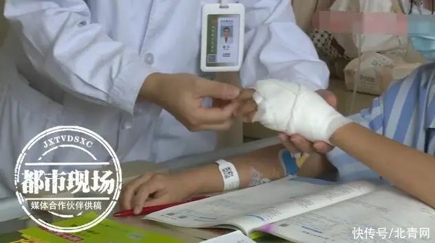 俊俊|男孩不小心弄断体温计，几天后手越来越肿，医生这样说