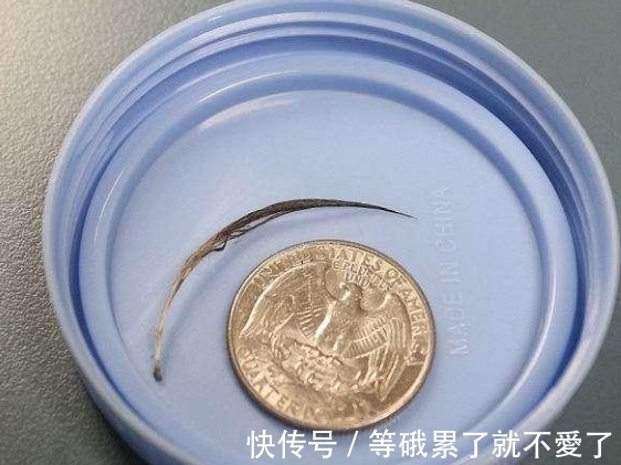 bober|女孩哭喊着挠脖子,到医院取出来的东西,全场人情绪失控