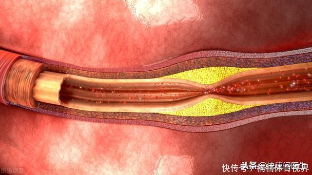 每天早上吃一个水煮蛋,对身体到底好不好?医生这回说了良心话