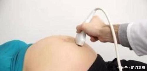 俩人|孩子出生吓得护士都不敢抱！原因竟是因为女子流产多次！