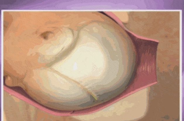 宫口|顺产到底有多疼,给你们看完这18图片,就能真正理解女人不容易