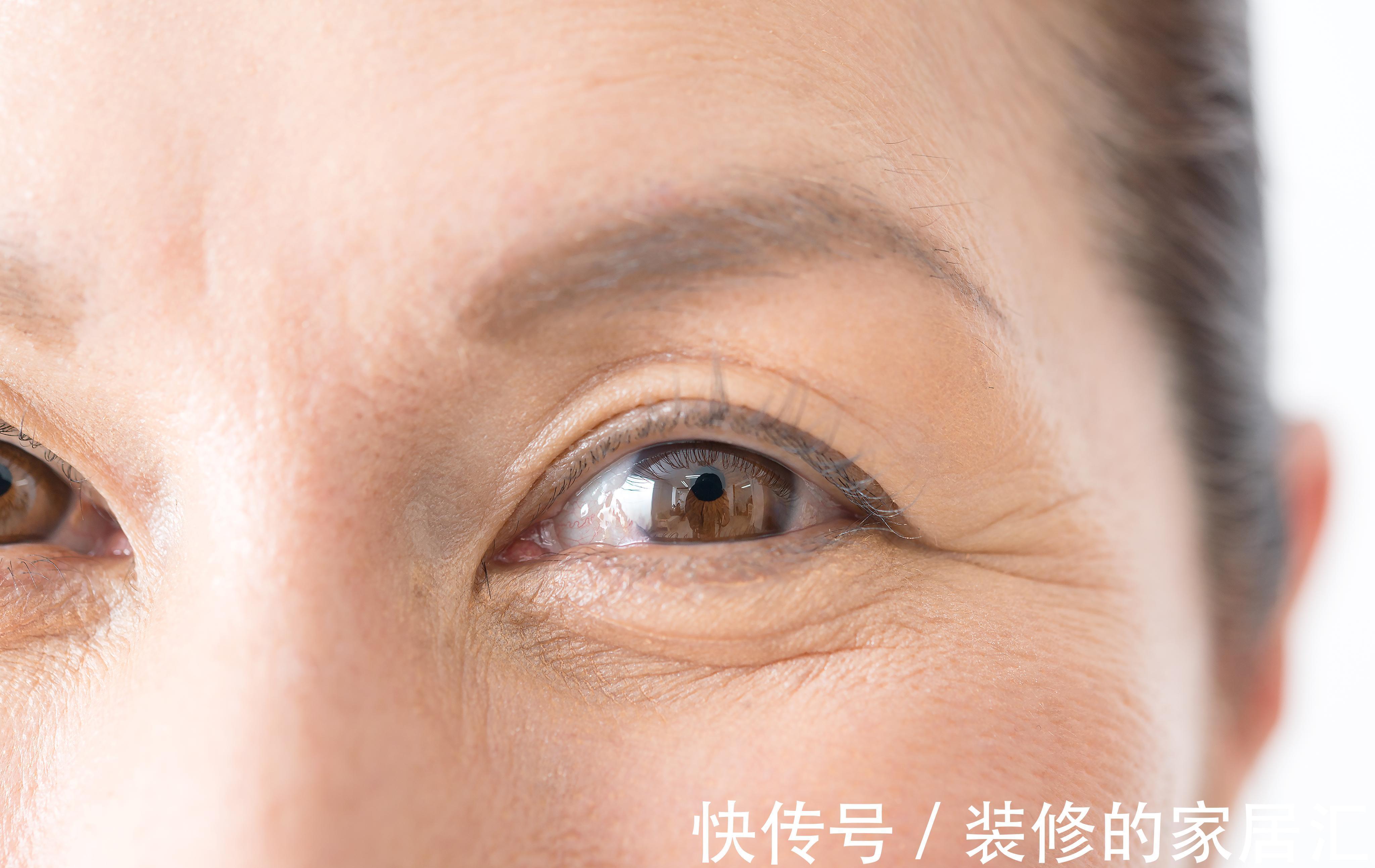 伤害|身体出现这4种现象，或是脑梗来临，早一点发现，便可以避免伤害