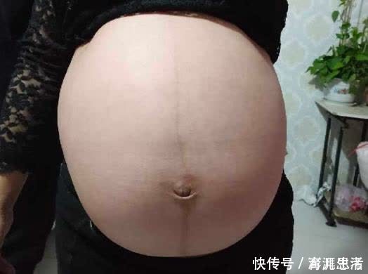 脐带|脐带绕颈后，准妈妈要做到一点，有利于自然绕出