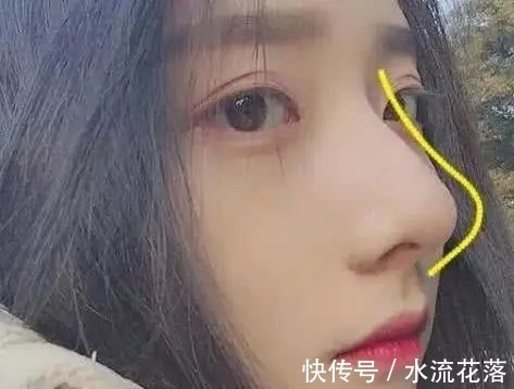 大蒜|被公认的三种“丑鼻子”，中了颜值不会太高，没中的小仙女偷笑吧