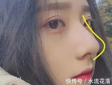 大蒜|被公认的三种“丑鼻子”,中了颜值不会太高,没中的小仙女偷笑吧