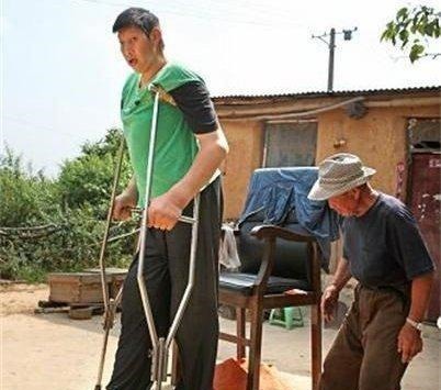 世界上最高的5个人清朝巨人詹世钗3.19米,