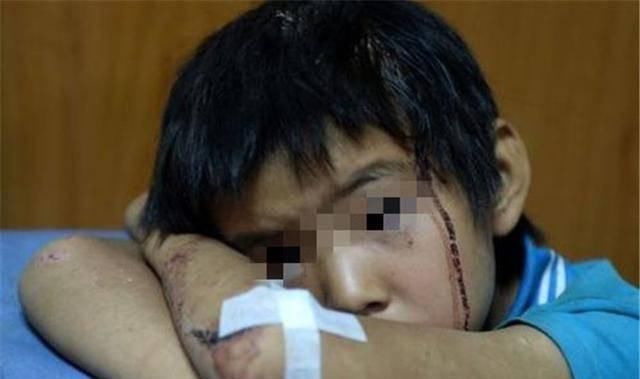 1岁孩童玩耍被推倒,哭了几声爬起来继续玩,第二天却闭上了眼