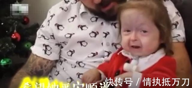 伊利斯|2岁女童看起来像80岁,病情独特全球首例,网友:希望返老还童