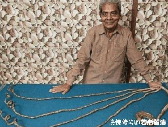 左手|老人用44年时间蓄留指甲,一朝剪掉后,不料手指却发生了新变化