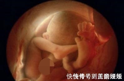 产妇|身怀五个月孕妇下身”见红“误以流产，急忙到医院却让医生憋着笑
