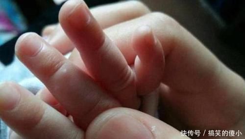 丽丽|宝宝若这3个部位短,将来或许不会太高,快看看有没有你家孩子