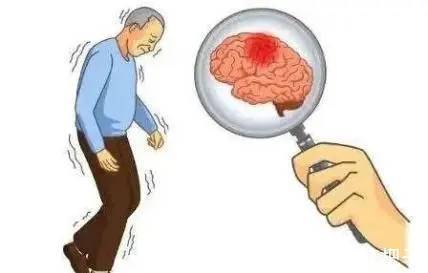 特异性|正确认识多系统萎缩，及时发现症状，及时干预良好预后。