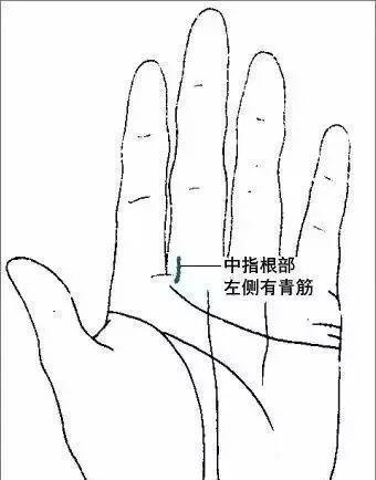 积滞|手上有一条青筋，没事刮一刮，可有效防治脑血栓！身体越来越棒！