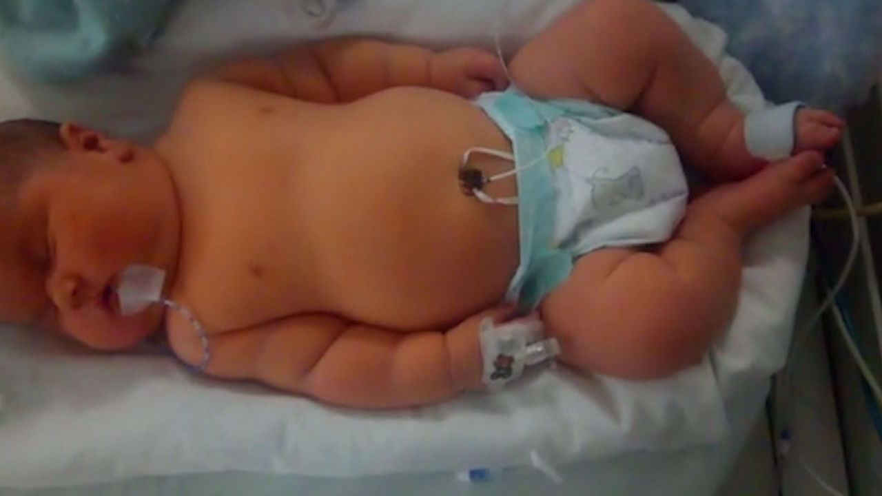 米切尔|英国一位妈妈生下13斤重婴儿 系该国第三重