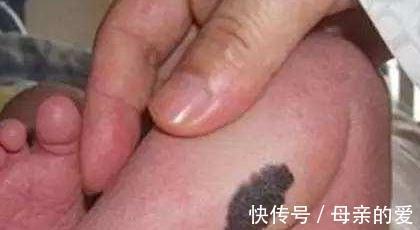 妈妈们|怀孕期间孕妈坏脾气对胎儿有影响,莫等宝宝畸形才知错