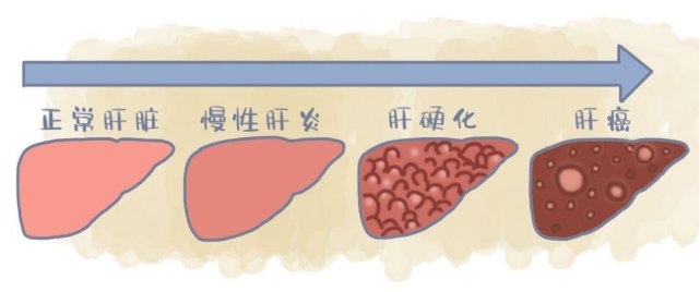 生命|78岁大爷才100斤！这种常见病每天夺走数千人生命