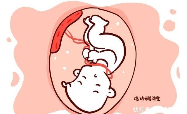 孕妈们|剖腹产的最佳时间为什么在孕38周、39周，而不是40周以后？