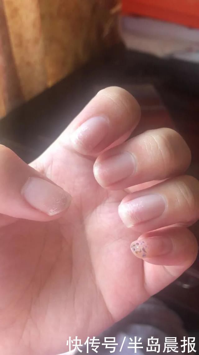 萧内网|原本多好看的手,现在成这样了,姑娘:美甲做多的下场