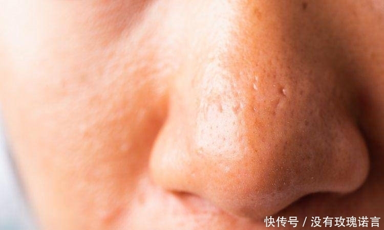 这些清洁面膜如果停产了，我简直世界崩塌！