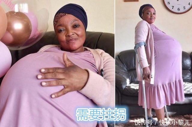 准妈妈|生10胞胎是什么体验?南非产妇将打破世界纪录,丈夫此前并不相信