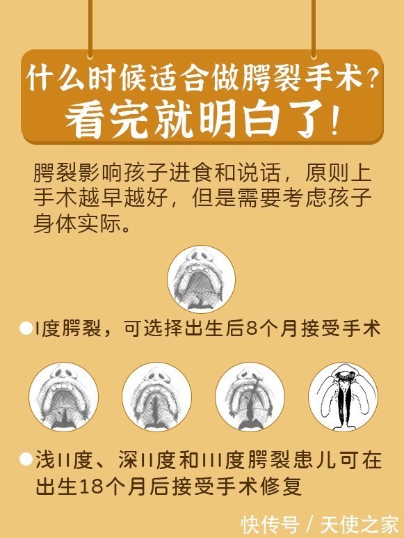 张磊涛|《天使科普》关爱兔唇宝宝 张磊涛教授带你了解唇腭裂