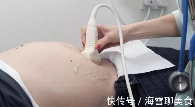 胎儿|十月怀胎，这几周是胎儿脐带绕颈“高发期”，孕妇要早知道早预防