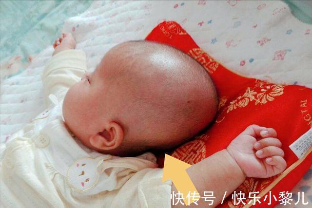头型|育儿“妙招”其实是“损招”!新生儿前3个月护理是关键,别大意