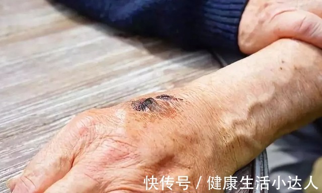 健康食品|20个癌症信号,一旦出现,要引起注意,尤其是有3个习惯的人