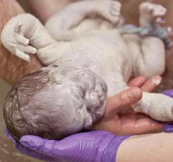 乳白色|新生儿全身涂满“猪油”,母子相见吓坏产妇医生这是好事