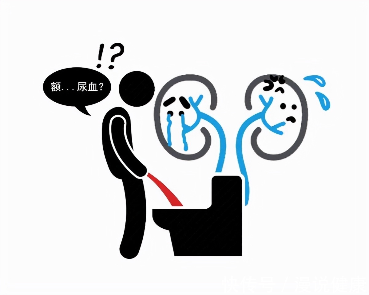 肾脏健康|肾有癌,腰先知?腰部出现这种现象,多半人误认为是腰肌劳损