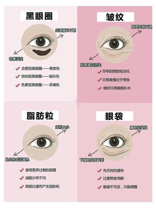 眼部|黑眼圈 、眼袋、 眼角纹、 脂肪粒，它们的形成原因你知道吗？