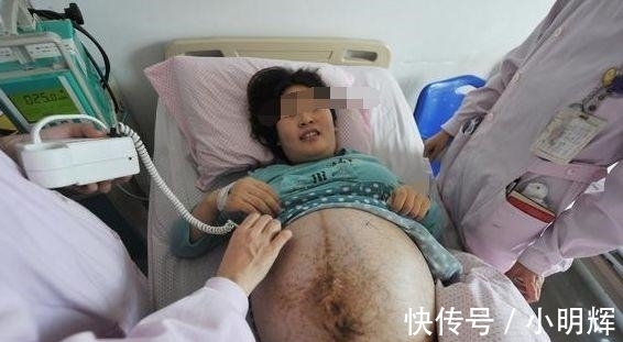 孕妇|90后孕妇生下四胞胎,婆家兴高采烈抱孙子,娘家哭成泪人