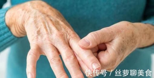 关节炎|不论男女，手上若有这种表现，小心类风湿性关节炎“找上门”！
