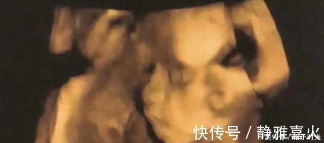 孕友|肚子里的胎儿有“七大怕事”,准妈妈不要再做了,以免伤身又伤娃