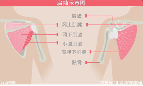 肩峰|肩疼未必肩周炎 这种病偏爱“勤快人”