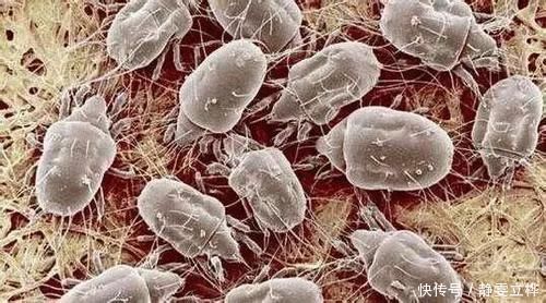 洗床单时,在水里加一点“它”,只要1分钟就可以去除螨虫