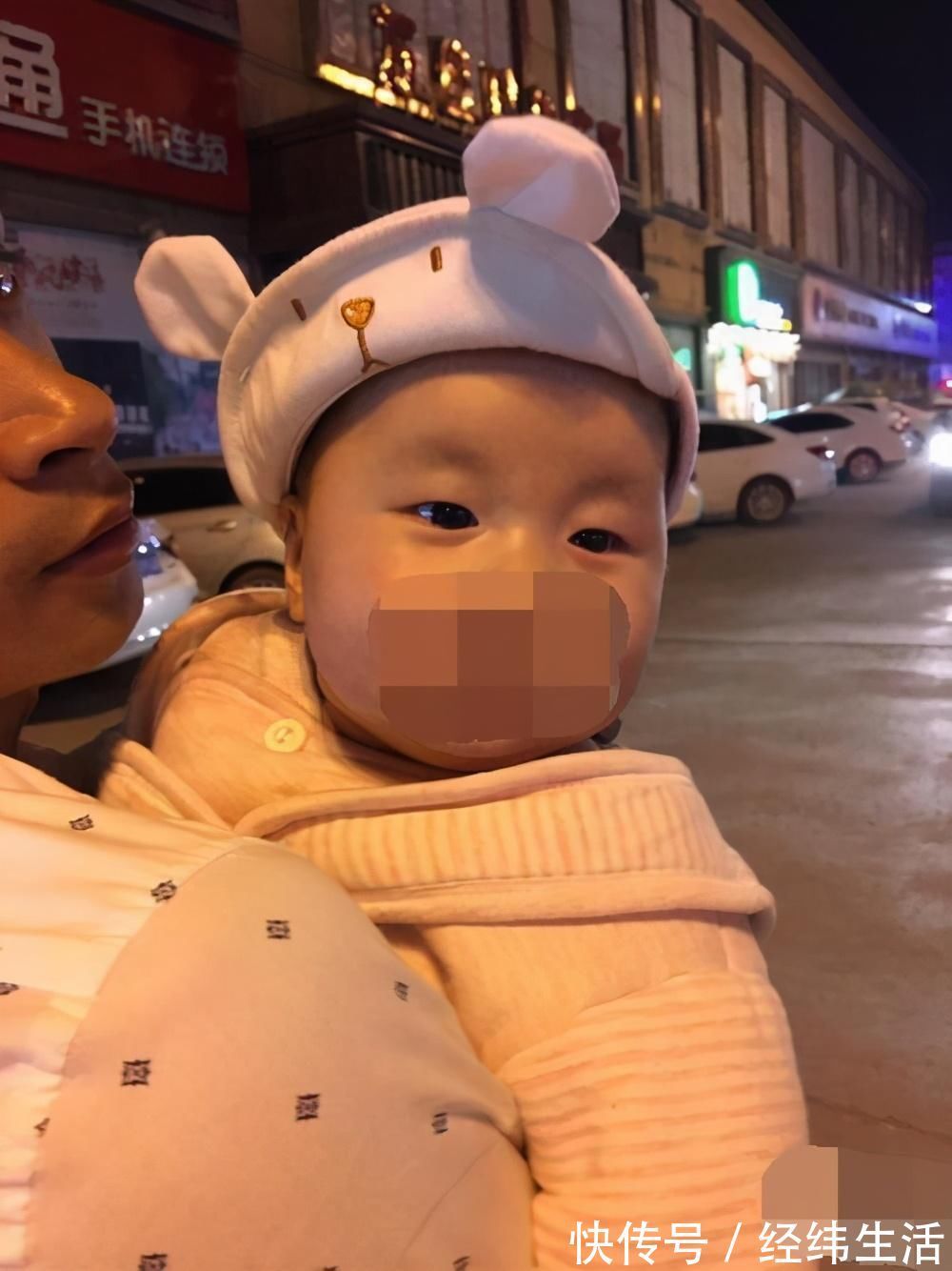 单眼皮|为啥新生儿双眼皮迟迟“不上线”,这3原因是关键,有1种超无奈