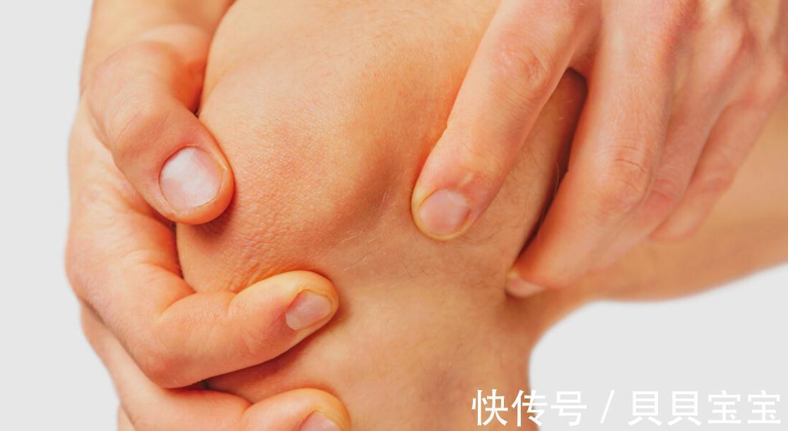 医生|类风湿关节炎有什么症状，你知道吗，医生帮你科普
